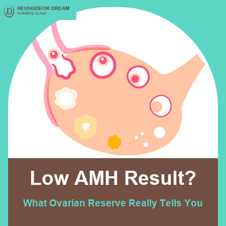 Low AMH (Ovarian Reserve): Does It Mean Pregnancy Will Be Difficult?