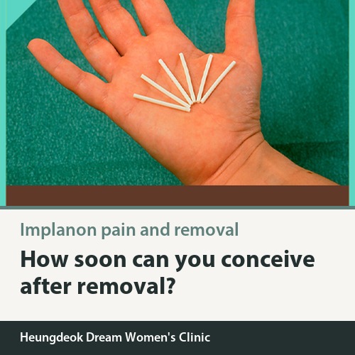 Implanon Insertion Pain: When Can You Get Pregnant After Removal?