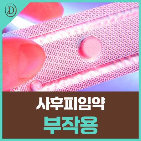 사후피임약 부작용, 복용 뒤 어떤 증상까지 지켜봐도 되나요?