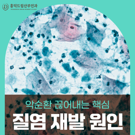 질염이 자꾸 재발한다면? 원인부터 다시 짚어야 하는 이유